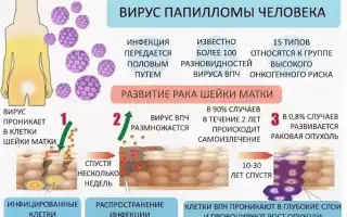 ВПЧ у женщин при беременности: причины, симптомы, опасность, лечение