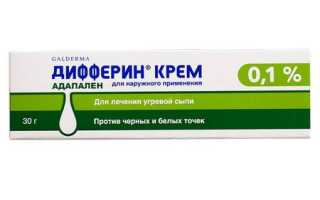 Рейтинг средств против открытых и закрытых комедонов — фармакологические группы препаратов