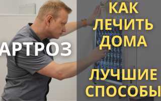 Артроз коленного сустава — лечение в домашних условиях