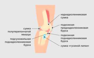 Бурсит коленного сустава — что это такое, основная информация