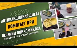 Как правильно питаться при лечении грибка ногтей?