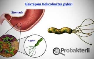 Бактерия Helicobacter pylori может стать причиной вздутия живота