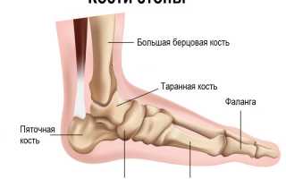 Боль в пятках — причины возникновения и методы лечения