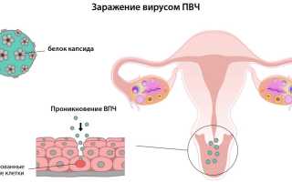 Как работают противовирусные средства — эффективная терапия ВПЧ