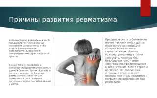 Ревматизм — симптомы и механизм развития недуга