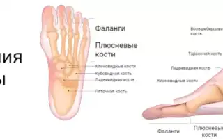 Боль в пятке при наступании — что её вызывает и как с ней бороться