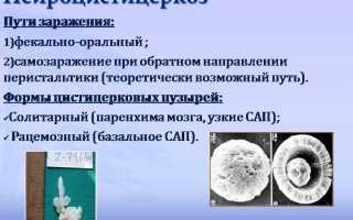 Что такое нейроцистицеркоз головного мозга: симптомы и лечение, фото