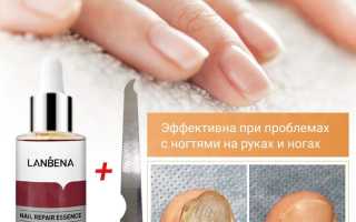Аптечные средства против грибка ногтей на ногах, обзор реальных проверенных лекарств