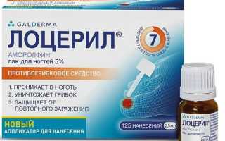 Лучшие лекарственные препараты от грибка ногтей на руках