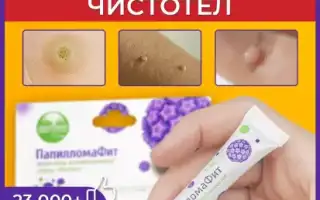 Наружные средства от папилломных наростов — эффективные мази и кремы при ВПЧ