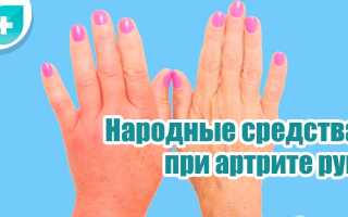 Артрит ревматоидный — лечение традиционное и народное