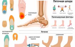 Пяточная шпора — опасное заболевание и его симптомы
