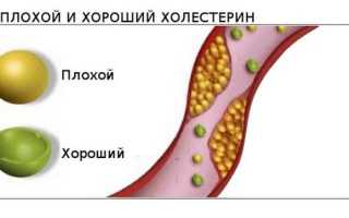 Как быстро снизить холестерин в домашних условиях: рецепты