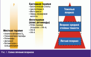 Какие бывают схемы лечения псориаза? NSP программа, стандарты, различные методики