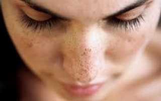 Отзывы об отбеливающей маске «Miracle Glow»