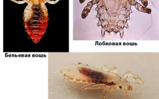 Средство от вшей обработка мебели