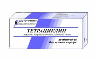 Что нужно знать о мигренях – психосоматика и лечение