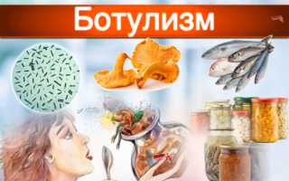 Симптомы ботулизма и лечение у взрослых