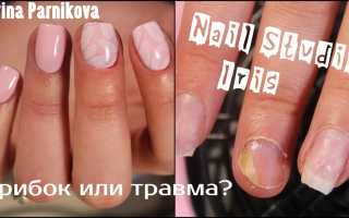 Стоит ли делать маникюр и наращивание ногтей при грибке?