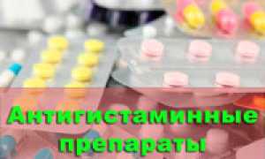 Антигистаминные лекарства: классификация, обзоры, особенности применения и побочные реакции