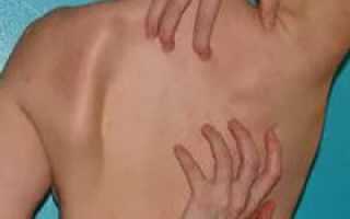 Причины, почему спина чешется и методы лечения зуда в области лопаток