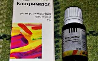 Как применяется препарат Клотримазол против грибка ногтей (онихомикоза)?