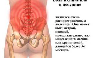 Боль в пояснице — виды, причины, симптомы, лечение