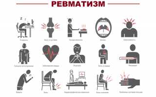 Осложнения и симптомы ревматизма суставов