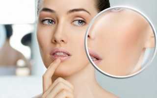 Химические пилинги Sesderma: что это такое, цены, фото до и после