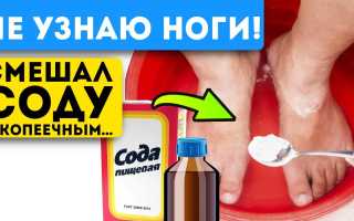Пищевая сода от грибка ногтей: ванночки, лечебные компрессы, паста