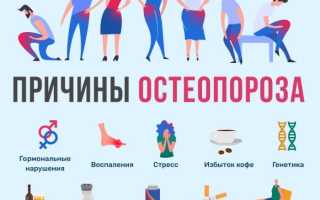Профилактика остеопороза у мужчин, женщин и детей