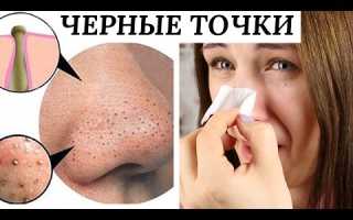 Какая косметика от черных точек действительно помогает?
