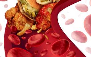 Как быстро и эффективно снизить холестерин только продуктами