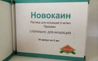 Симптомы и лечение аллергии на новокаин