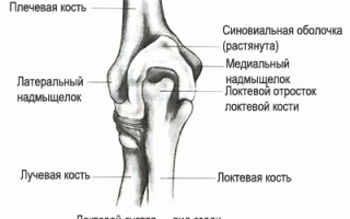 Причины хруста в локтевом суставе и методы его лечения