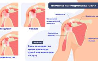 Боль в плечевом суставе — типы боли и их значение