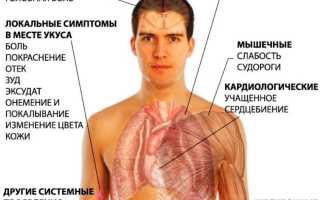 Что делать если укусила черная вдова: на сколько опасен укус, лечение