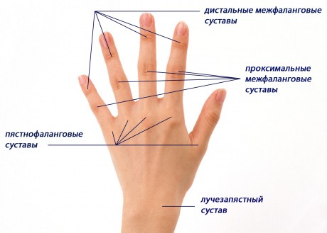 Суставы кисти руки фото