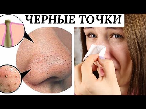 косметика от черных точек