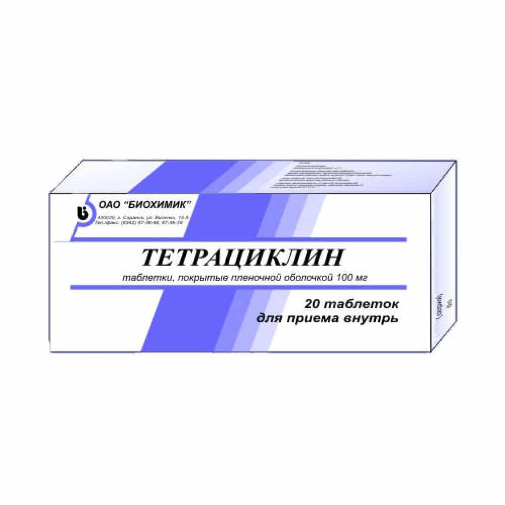 мигрень