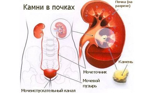 Противопоказания по употреблению корня шиповника