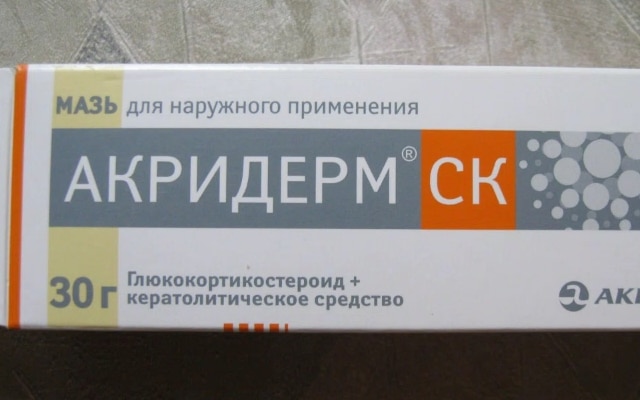 Тактика лечения
