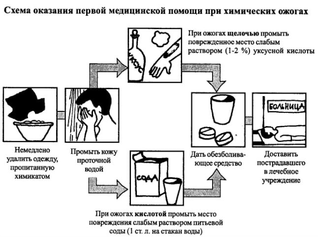 первая помощь при химическом ожоге