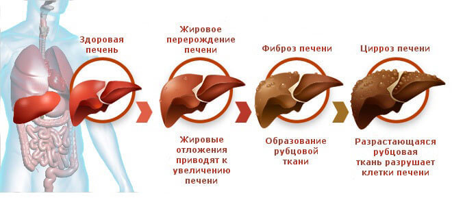 content_ochischenie_pecheni__econet_ru