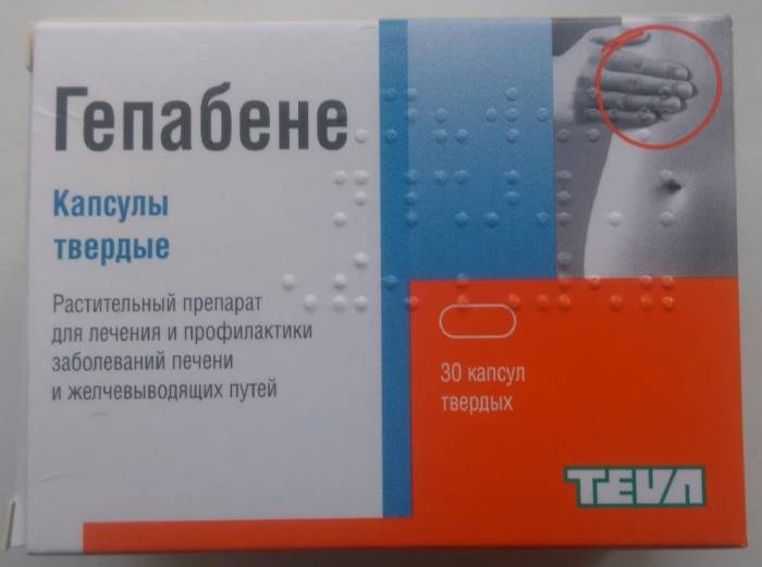 Деформация желчного пузыря