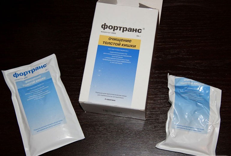 Фортранс