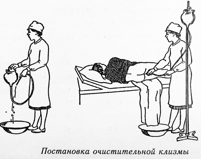 как ставить клизму