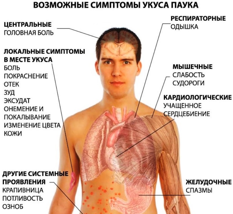 ukus-pauka simptomy