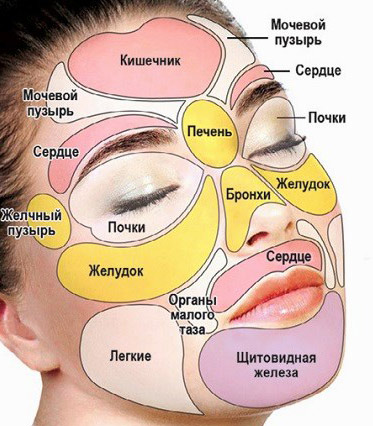 О проблемах с какими органами сигнализирет появление внутренних прыщей на лице