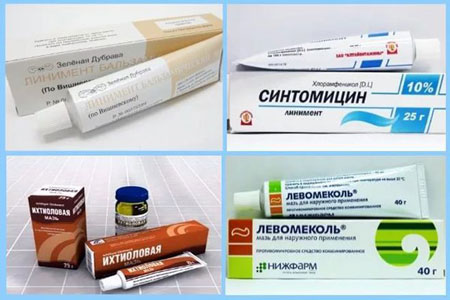 Как лечить фурункул в домашних условиях быстро - лучшие мази